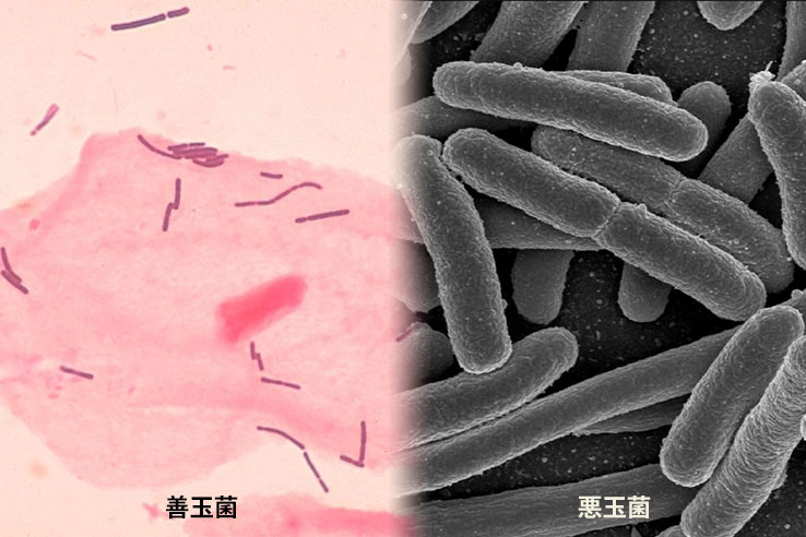 悪玉菌と乳酸菌の関係は？